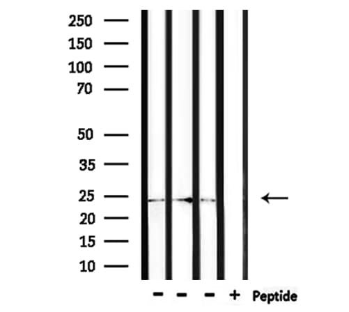 Polyclonal Rabbit anti-Human ZNRF1 Antibody (IHC, IF, WB)