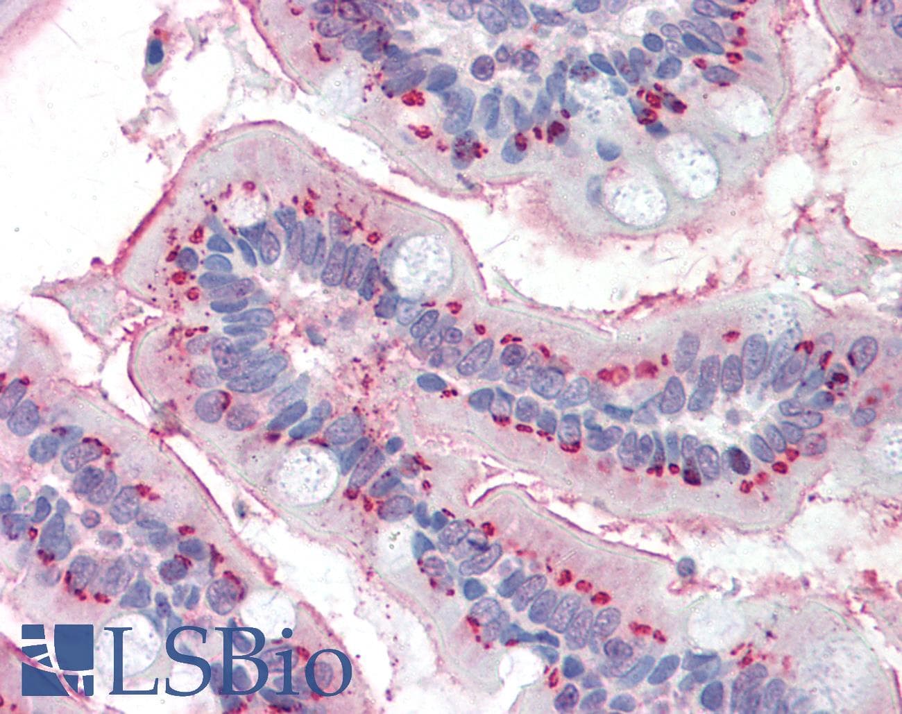 IHC-plus™ STK3 Antibody (clone 4G10)