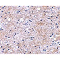 Polyclonal Rabbit anti-Human LGI1 Antibody (IHC, IF, WB)