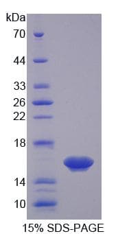 Mouse Osteoglycin / Mimecan Protein (Recombinant His)