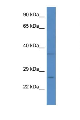 CHCHD6 Antibody (aa69-118)