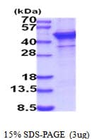 Human ST6GAL1 / CD75 Protein (Recombinant His)