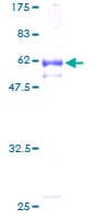 Human NKD2 Protein (Recombinant GST)