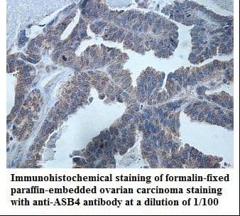 ASB4 Antibody (aa164-337)