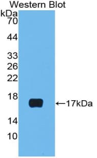 LHB / Luteinizing Hormone Antibody (aa23-141)