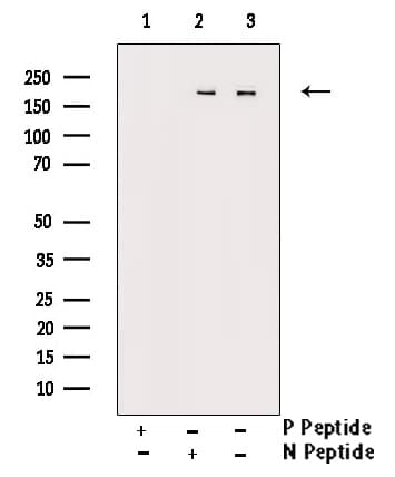 Polyclonal Rabbit anti-Human FANCD2 Antibody (phospho-Ser222, IHC, IF, WB)