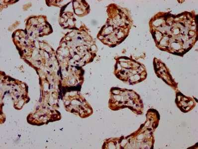 RIOK2 Antibody