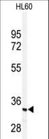 PRKRA / PACT Antibody (Ser246)