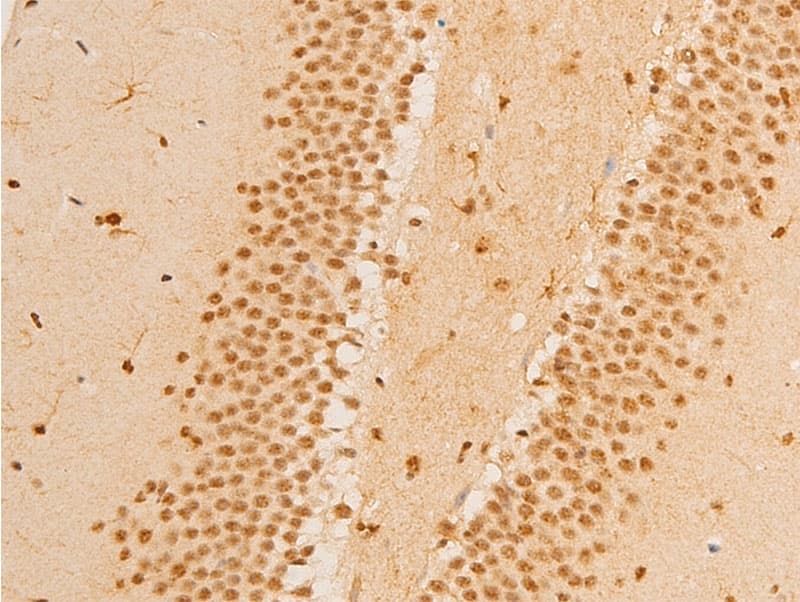 Polyclonal Rabbit anti-Human FOXO3 / FOXO3A Antibody (phospho-Ser253, IHC, WB)