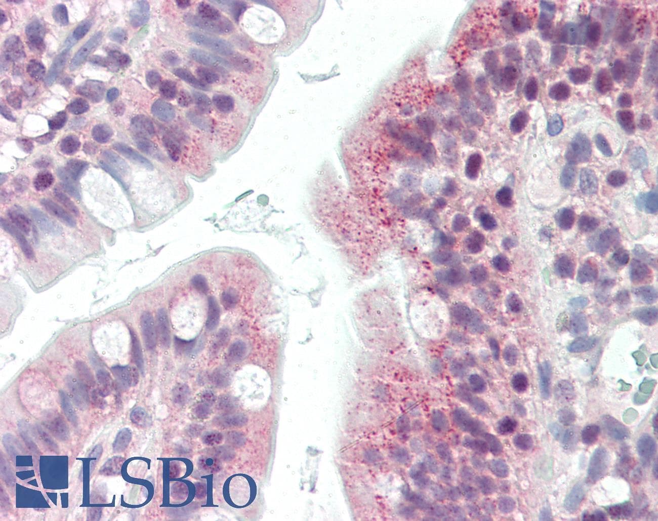 IHC-plus™ CIDEB Antibody