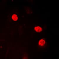 HMGN2 Antibody (N-Terminus)