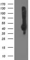 NEU2 / Sialidase 2 Antibody (clone OTI8C12)