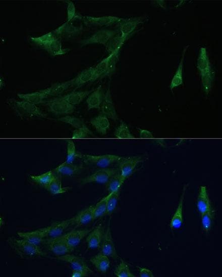 Polyclonal Rabbit anti-Human ARFL3 / ARL3 Antibody (IF)