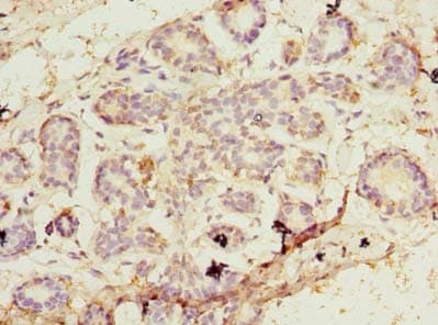 Polyclonal Rabbit anti-Human PA2G4 / EBP1 Antibody (IHC, WB)