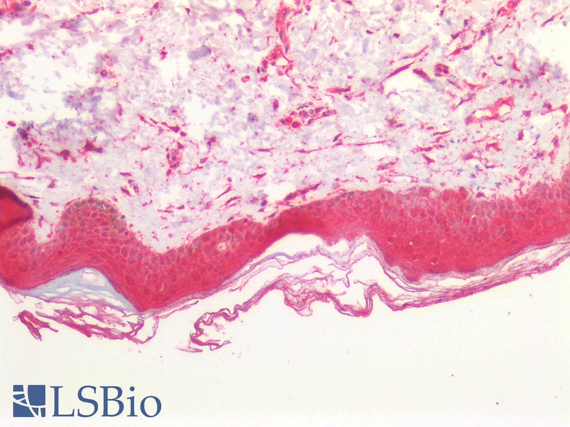 PathPlus™ BCL10 / BCL-10 Antibody (aa5-19)