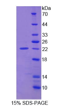 Rat Smoothelin Protein (Recombinant His)