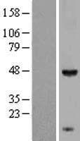 KCTD9 Protein (Over-Expression Lysate Myc-DDK (Flag))