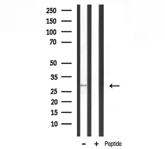 MRPL10 Antibody