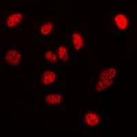 NPM1 / NPM / Nucleophosmin Antibody (C-Terminus)