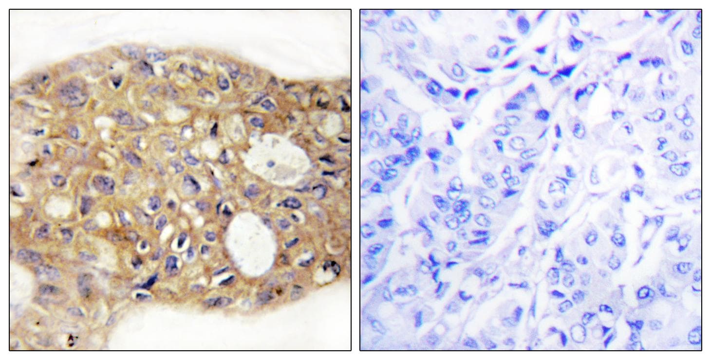 Polyclonal Rabbit anti-Human AG3 / AGR3 Antibody (IHC, IF)