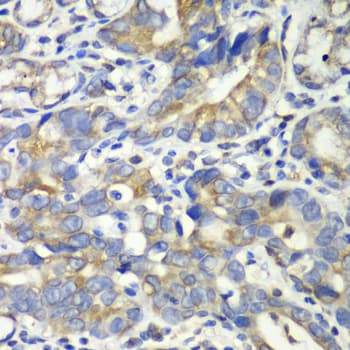 IHC-plus™ ABAT Antibody