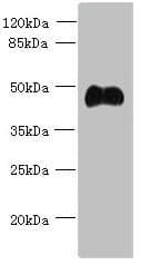 Polyclonal Rabbit anti-Human ABI3 Antibody (IHC, WB)