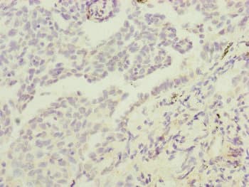 IF3mt / MTIF3 Antibody