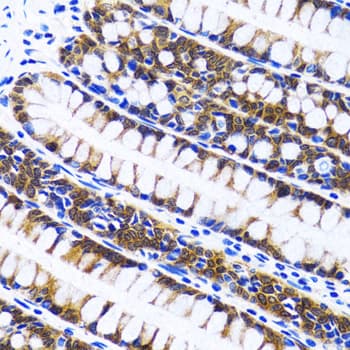 FASN / Fatty Acid Synthase Antibody