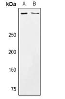 Polyclonal Rabbit anti-Human CSMD3 Antibody (WB)