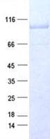 Human CTNNB1 / Beta Catenin Protein (Recombinant DDK,C-terminus)
