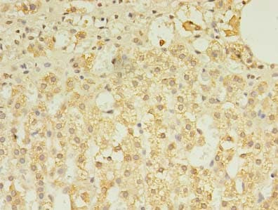 Polyclonal Rabbit anti-Human TLT2 / TREML2 Antibody (IHC)