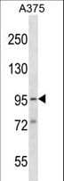 Polyclonal Rabbit anti-Human SYDE1 Antibody (aa1-30, WB)