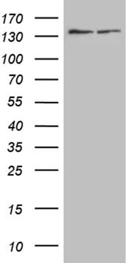SMC1A / SMC1 Antibody (aa889-1016, clone OTI1C5)