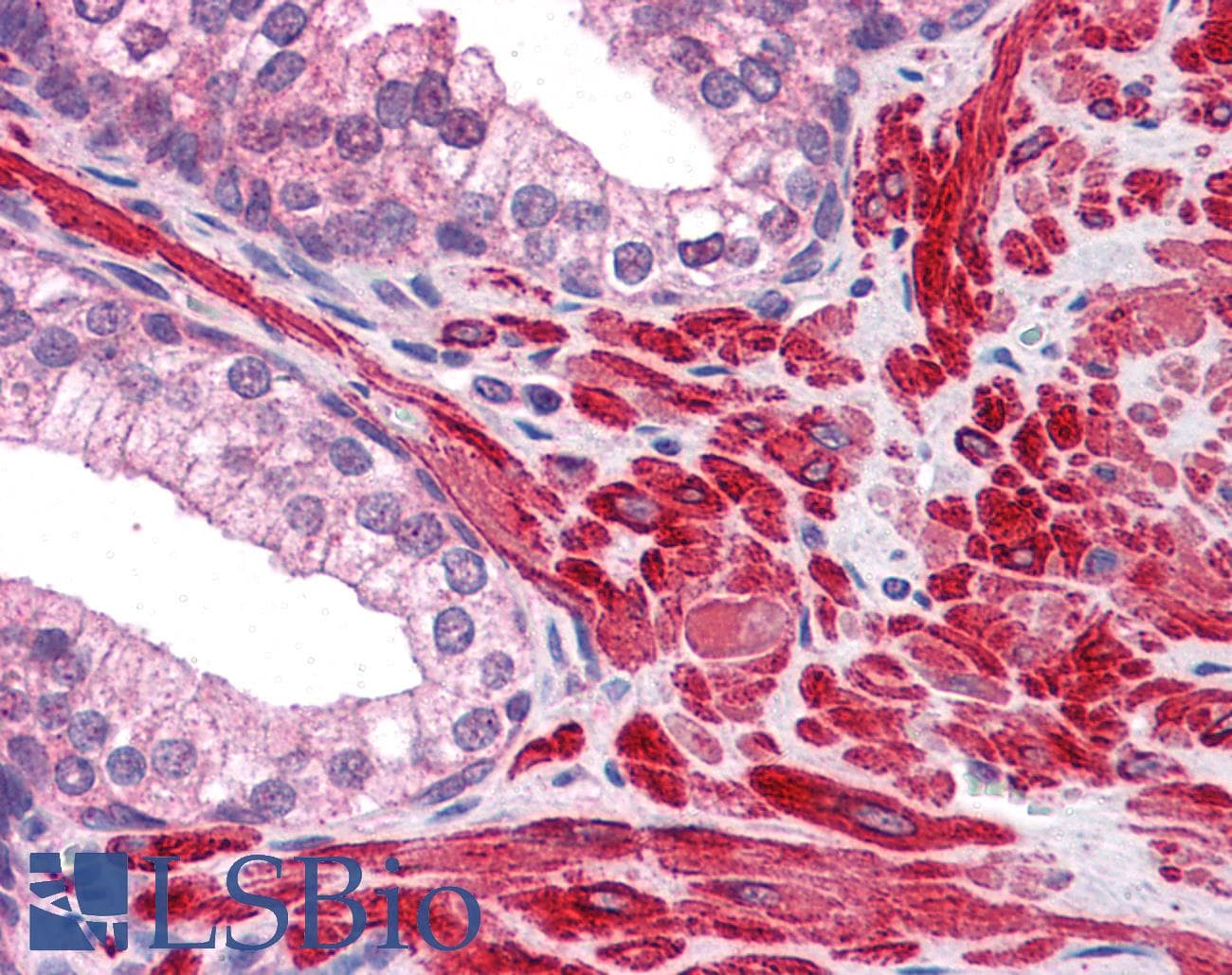 IHC-plus™ Polyclonal Rabbit anti-Human Dipeptidylpeptidase 8 / DPP8 Antibody (IHC, IF, WB)
