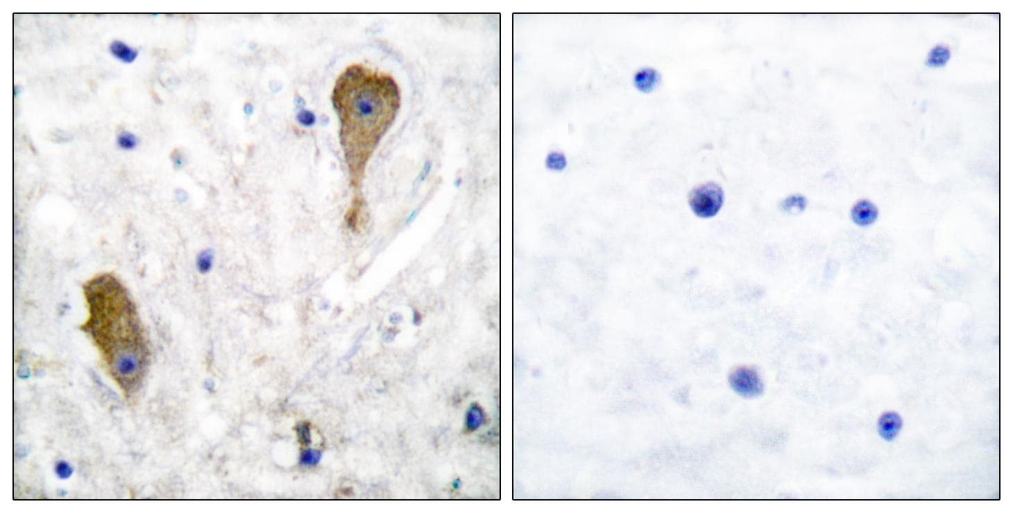 GAD1 / GAD67 Antibody