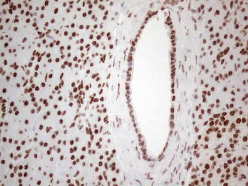 HNRNPL / hnRNP L Antibody (aa270-502, clone OTI4E5, Carrier-free)