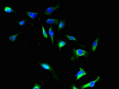 Polyclonal Rabbit anti-Human SFXN4 Antibody (IHC, WB)