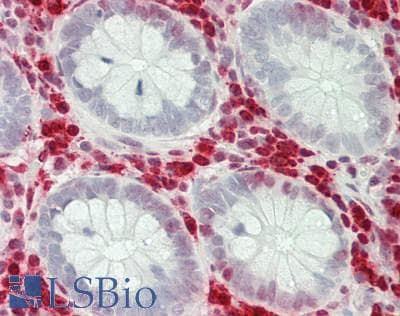 IHC-plus™ Polyclonal Rabbit anti-Human RNASE3 Antibody (aa102-151, IHC, WB)