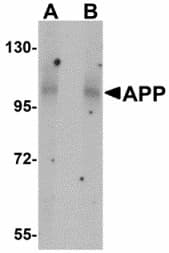APP / Beta Amyloid Precursor Antibody