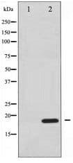 EIF4EBP1 / 4EBP1 Antibody