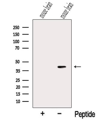 Polyclonal Rabbit anti-Human NECAP1 Antibody (WB)