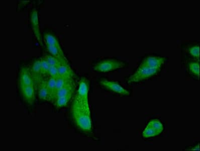 NPPB / BNP Antibody (aa27-102)