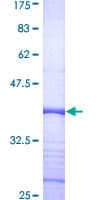 Human COPS6 / CSN6 Protein (Recombinant GST, N-terminus)