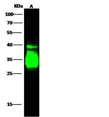 Polyclonal Rabbit anti-Human CD74 / CLIP Antibody (Preservative Free, IHC, WB)