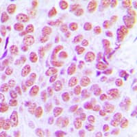 JUN / c-Jun Antibody (Internal)