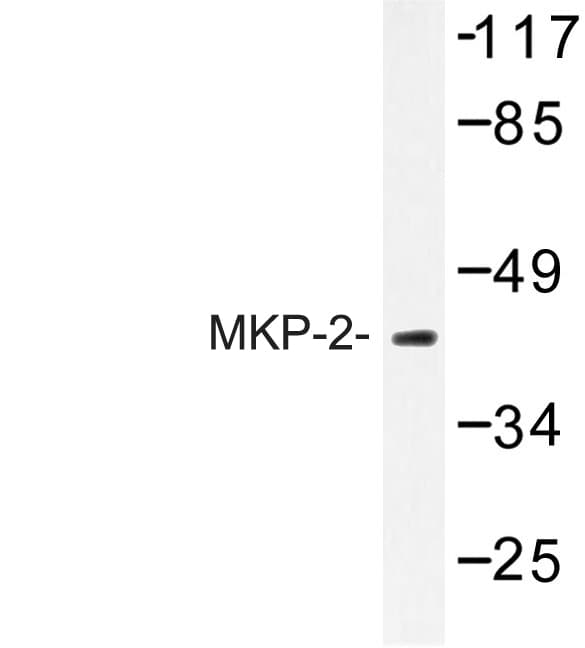 DUSP4 / MKP2 Antibody (Tyr108)