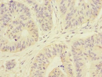 Polyclonal Rabbit anti-Human ARHGEF3 / XPLN Antibody (IHC)