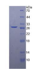 Human DGAT1 Protein (Recombinant His)