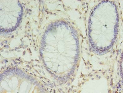 CHMP6 Antibody