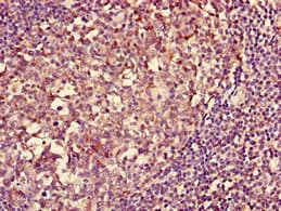 Polyclonal Rabbit anti-Human HLA-DQA1 Antibody (Biotin, IHC, WB)
